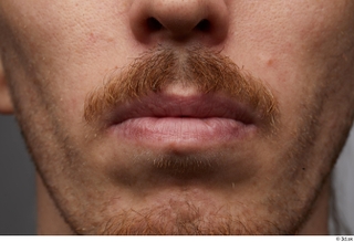 HD Face Skin John Hopkins face lips mouth skin pores…